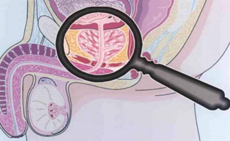 The prostate gland and its location